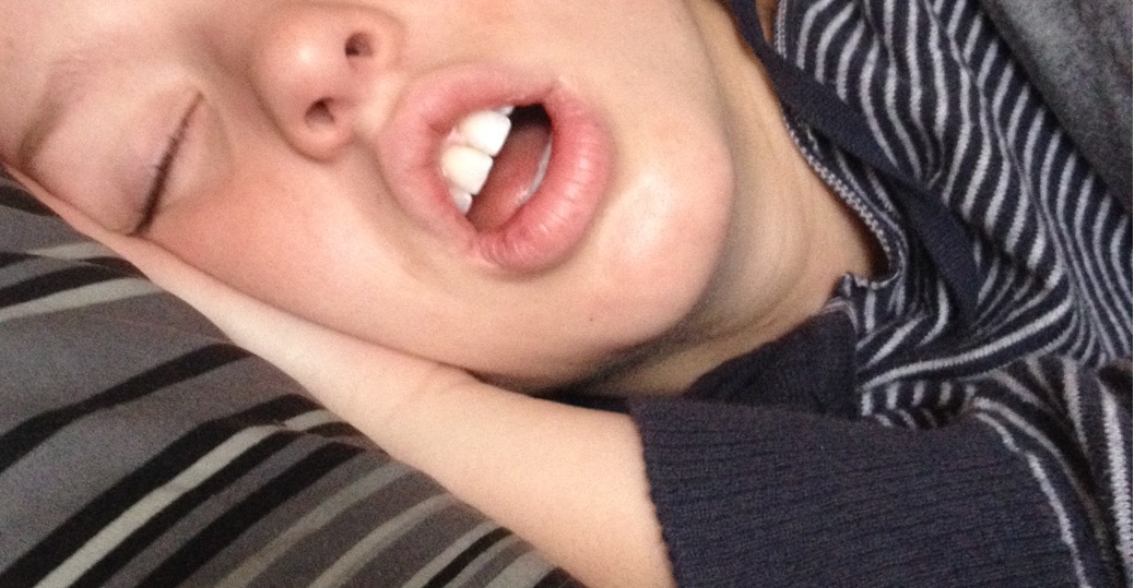 On jase : quoi faire pour être lady lorsque votre bouche ne ferme pas. Jamais.